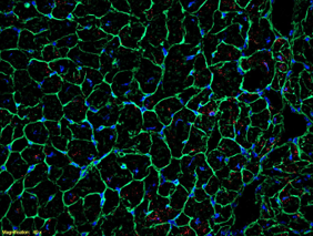 Wild-type mice expressing the mCherry-LC3 transgene under non-fasting, green WGA delineates cardiomyocytes.